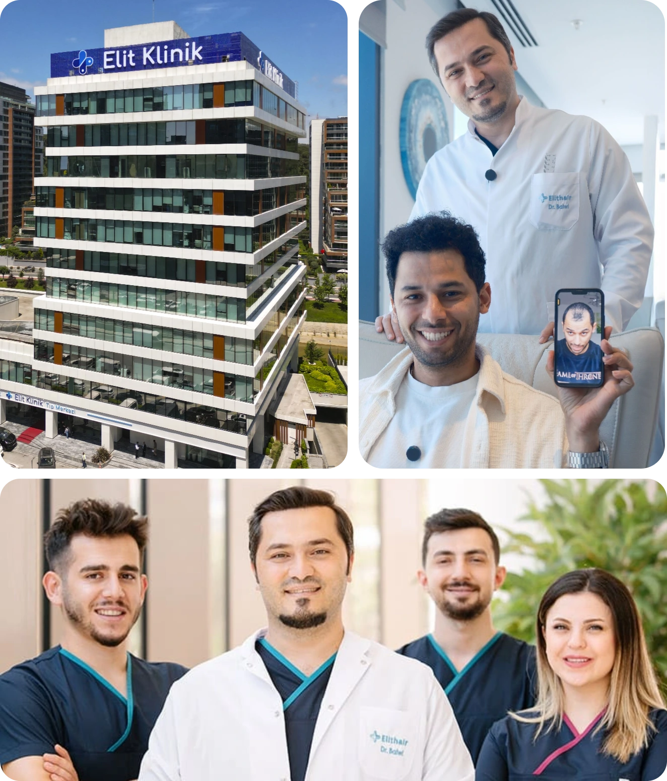 Elithair PRP Treatment